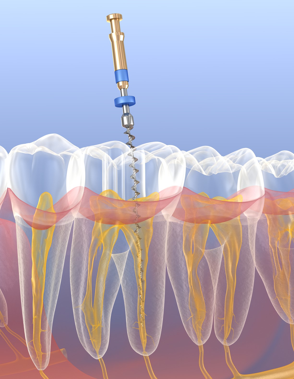endodontie tubize