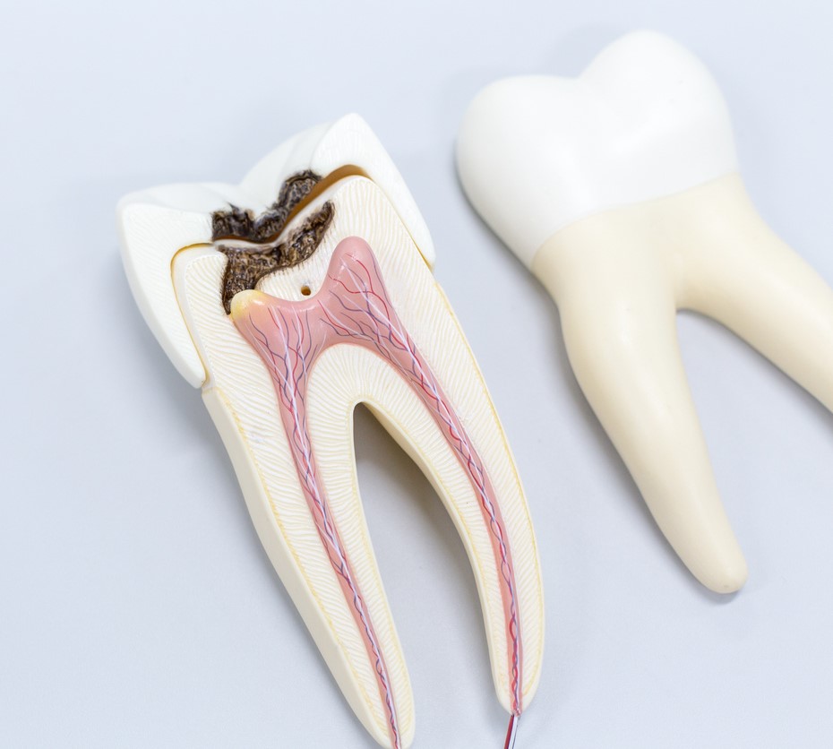 endodontiste tubize